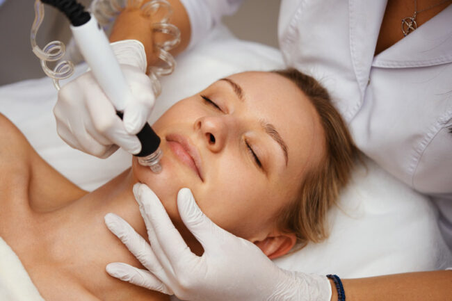 microdermabrasion